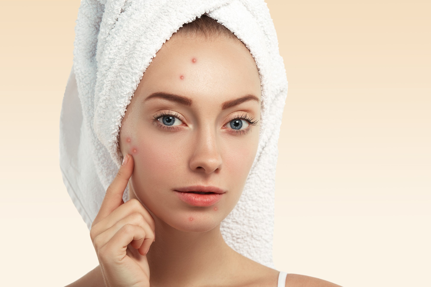 Acne Treatment In Dubai Skincare Routine For Lasting Results