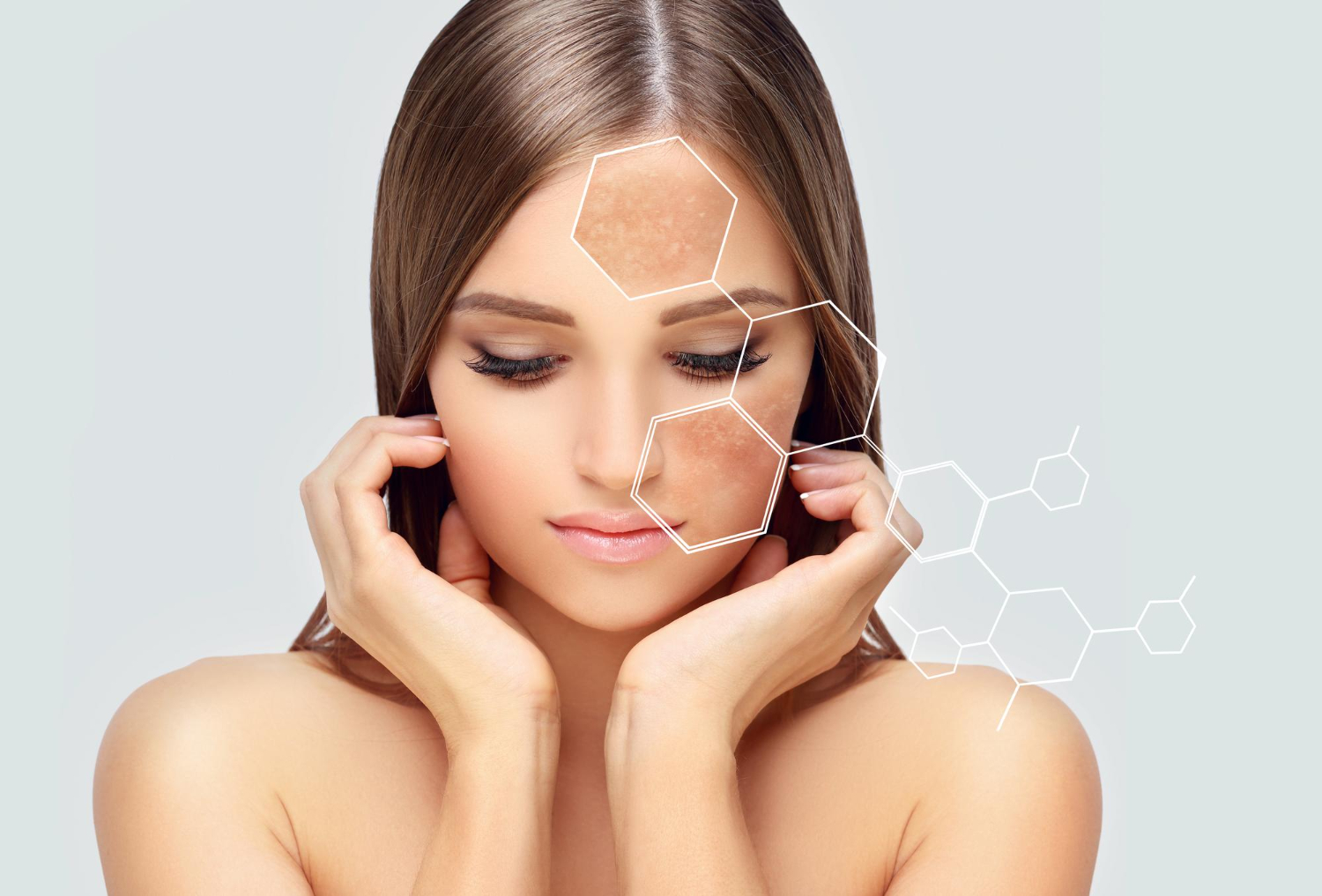 Pigmentation treatment in Dubai 4-Step Hyperpigmentation Plan