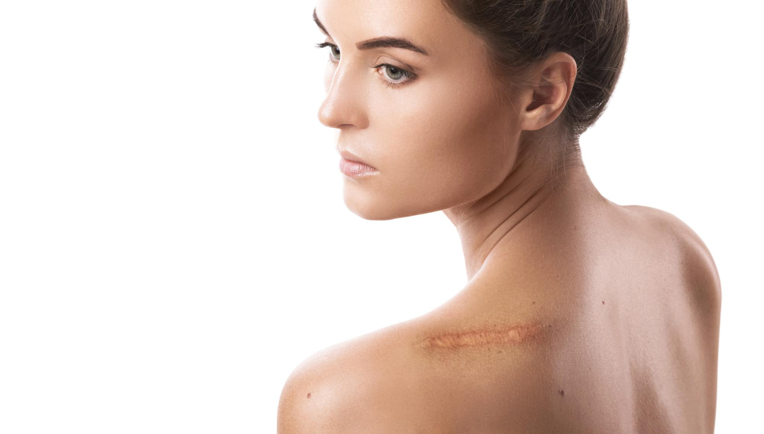 Scar Removal In Dubai Effective Treatments & Results